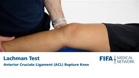 acl tear diagnostic test|lachman's exam schedule 2022.